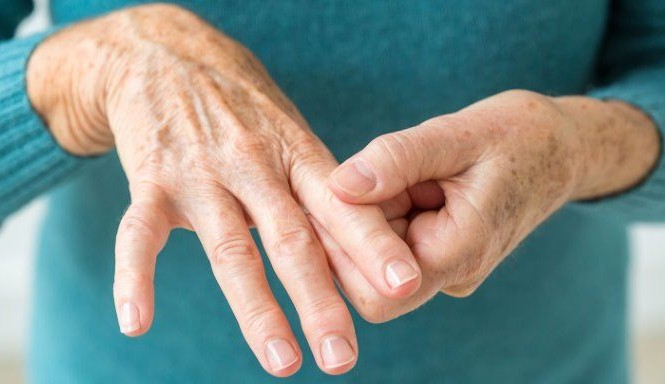 Tips-for-Living-with-Rheumatoid-Arthritis-01-1440x810